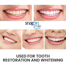 Snap On Teeth Whitening