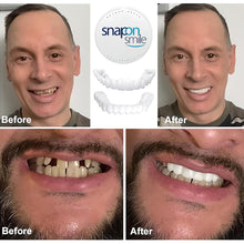 Snap On Teeth Whitening